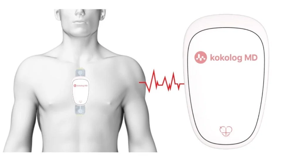 kokolog MD装着イメージ